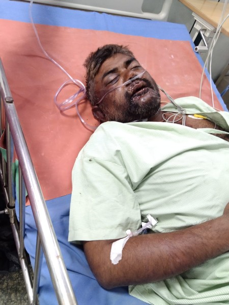 दबंग हमलावरों ने हॉकी राड से मारपीट कर युवक को किया मरणासन्न-रेफर
