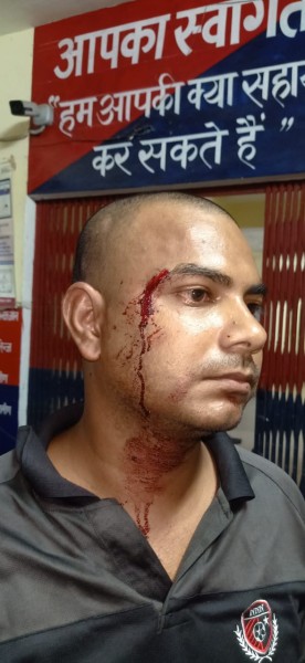 आईटीबीपी जवान से विवाद के बाद हिस्ट्रीशीटर के उकसाने पर साथी ने अवैध तमंचे से झोका फायर, घायल