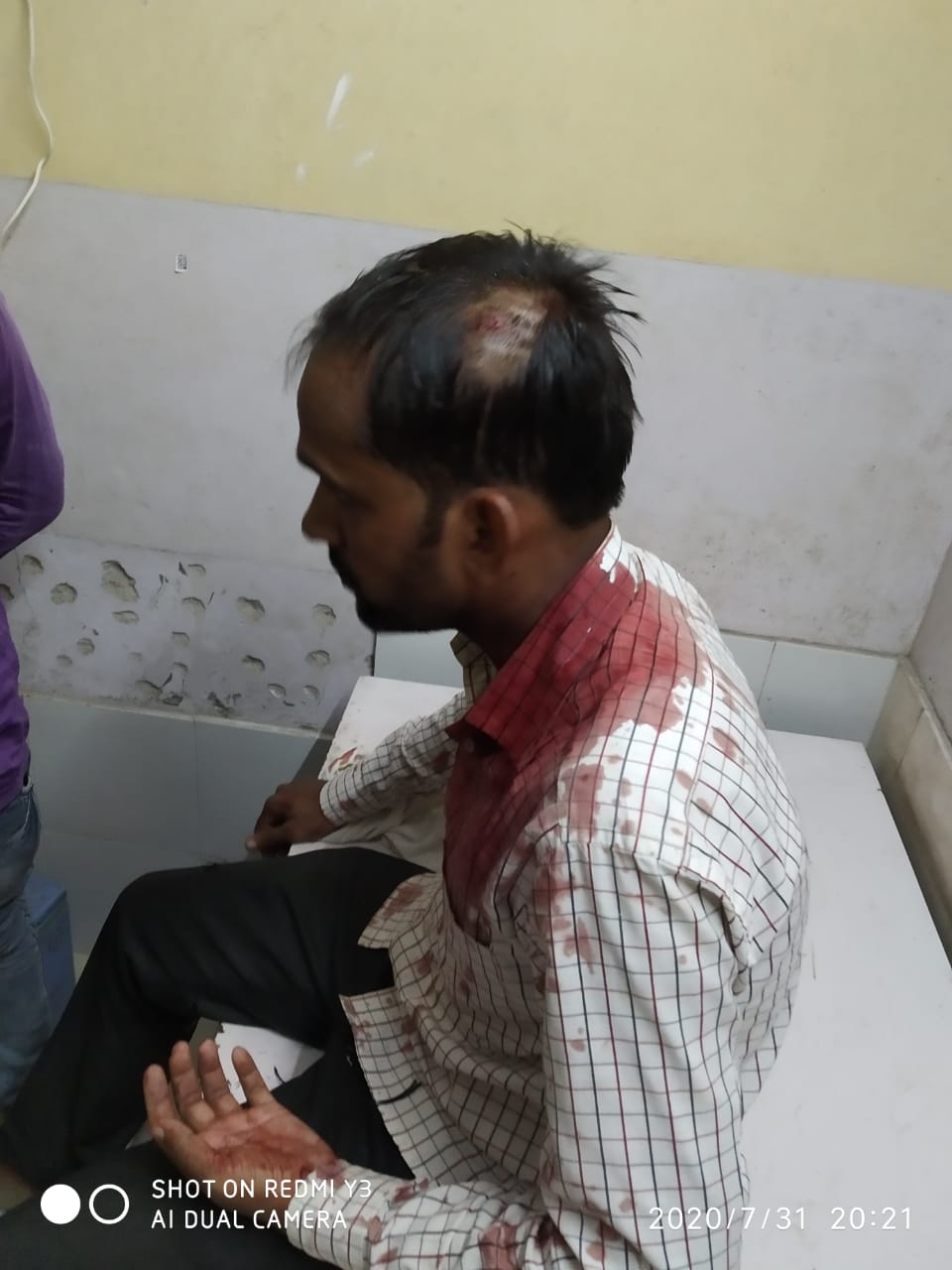 लूट में असफल बदमाशों ने तमंचे के बट से मारकर टाईनी संचालक को किया घायल --ग्रामीणों ने दो बदमाशों को दबोचा