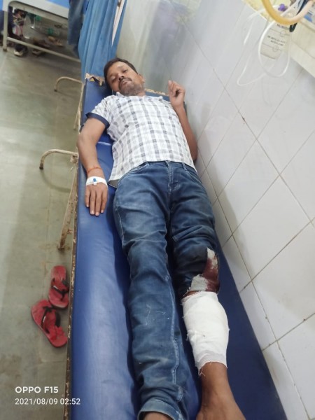 सिंघनी पुल के पास पुलिस मुठभेड़ में दो शातिर लुटेरे घायल, गिरफ्तार